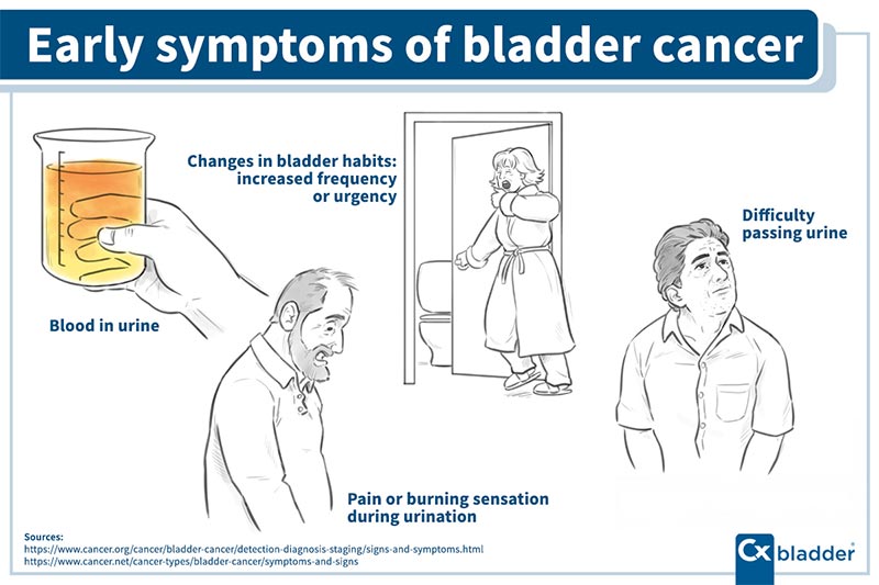 how do you diagnosis congestive heart failure